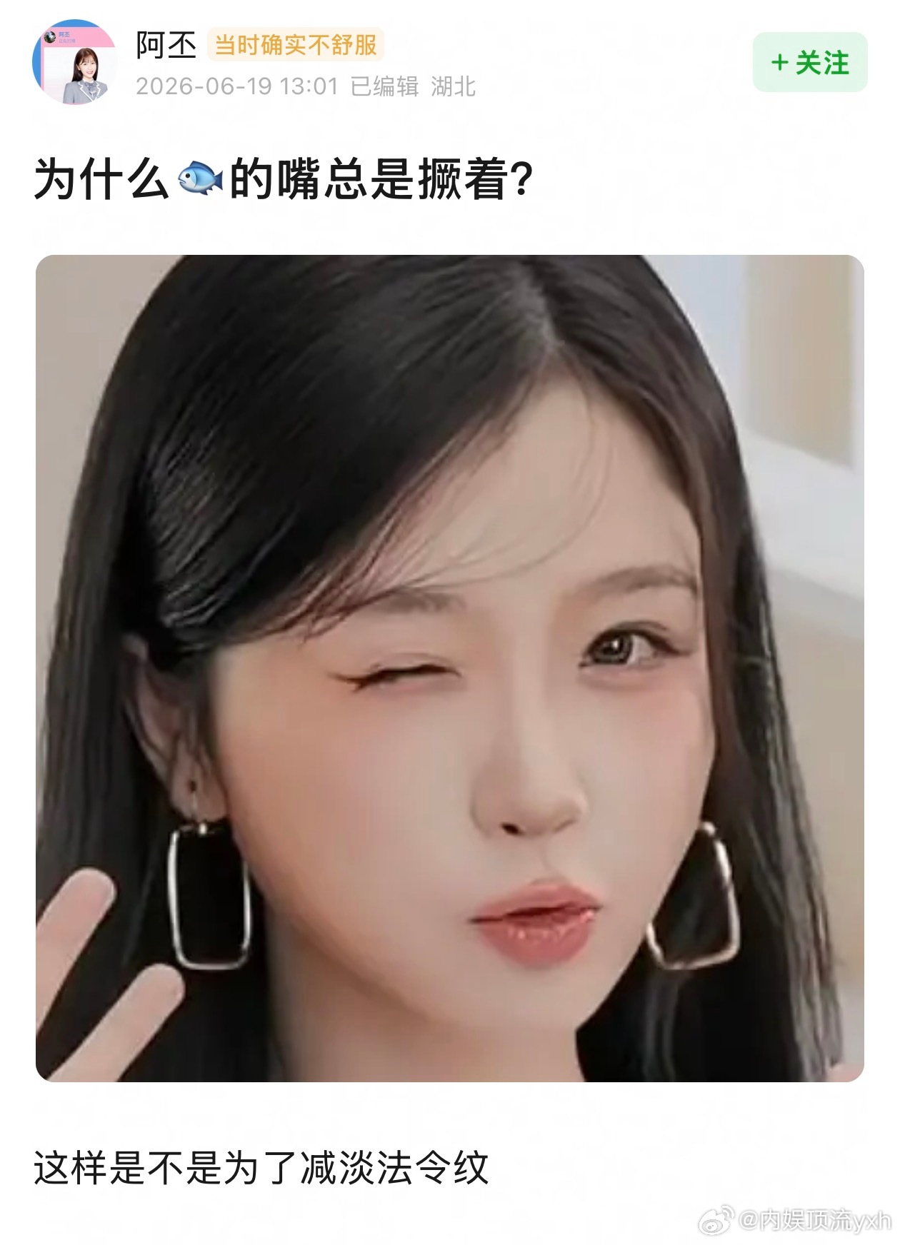 有网友说撅嘴能减少法令纹，真的能吗？ 