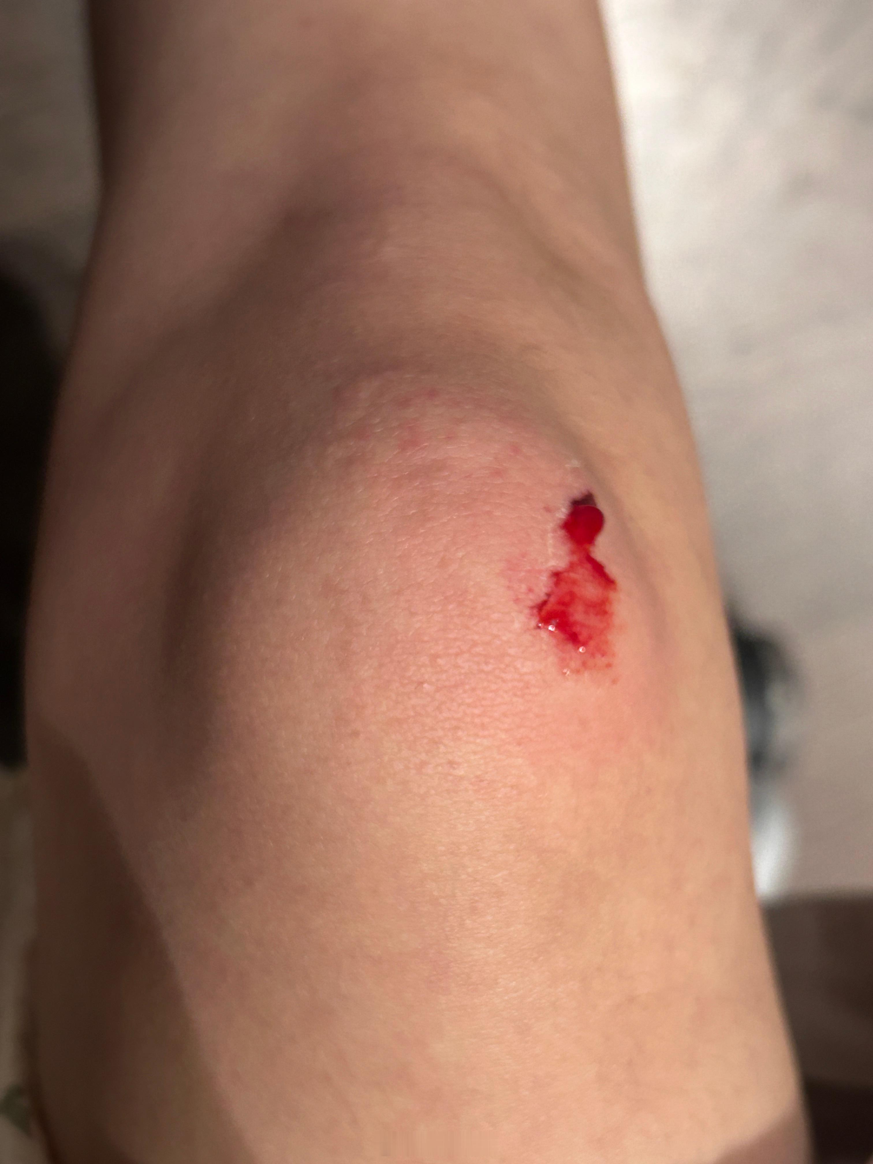 动物真的好神奇…我摔倒后起来突然发高烧 他俩就都在我旁边睡觉…陪伴我 平时根本不