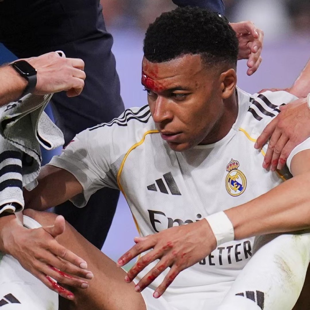 官方：姆巴佩上一场比赛眉骨被撞受伤出血后，出于谨慎和身体不适，缺席了今日训练。【