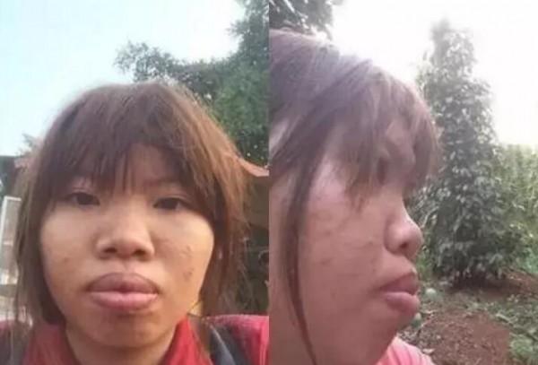 看到她的嘴唇，没觉得她难看，就是不自觉的感觉自己的嘴也往前凸。