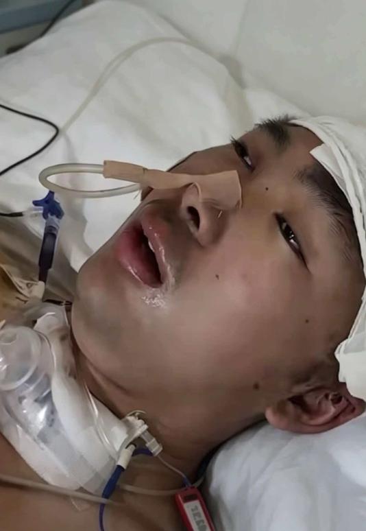距毕业仅剩半年！长春23岁硕士王斌散步时被16岁少年无证驾驶撞飞，昏迷4个月苏醒