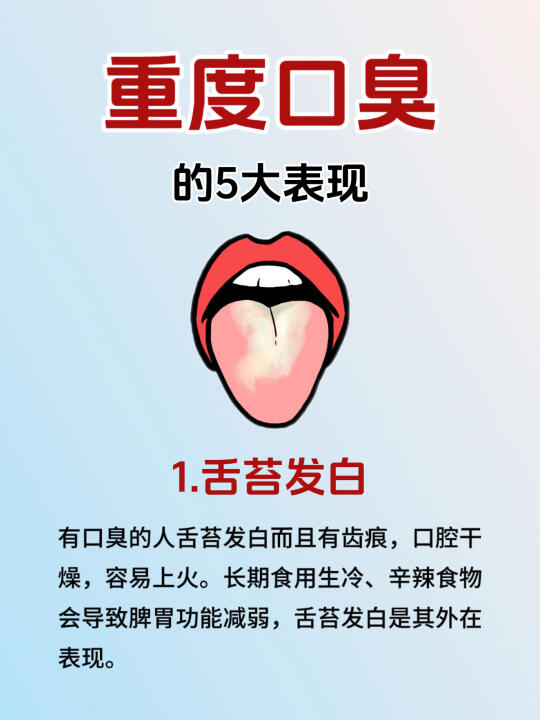 重度口臭的表现，快来看❗️