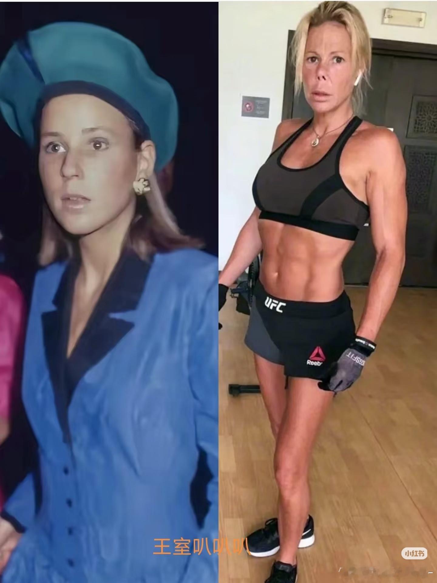 保加利亚公主卡莉娜，说是因为牙科手术严重感染了鼻子和眼睛 才变成这样。为了重拾信