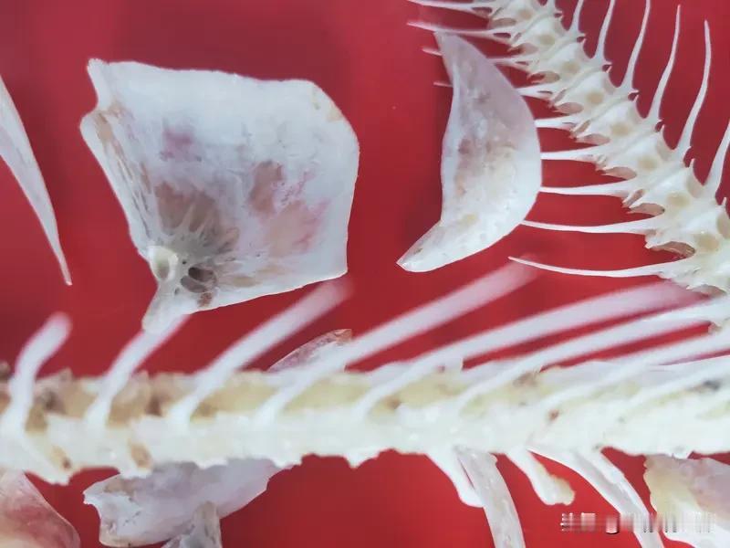 吃鱼几十年从来没卡过，这次竟然卡了那么长一根鱼刺，真是太衰了，怎么都出不来。

