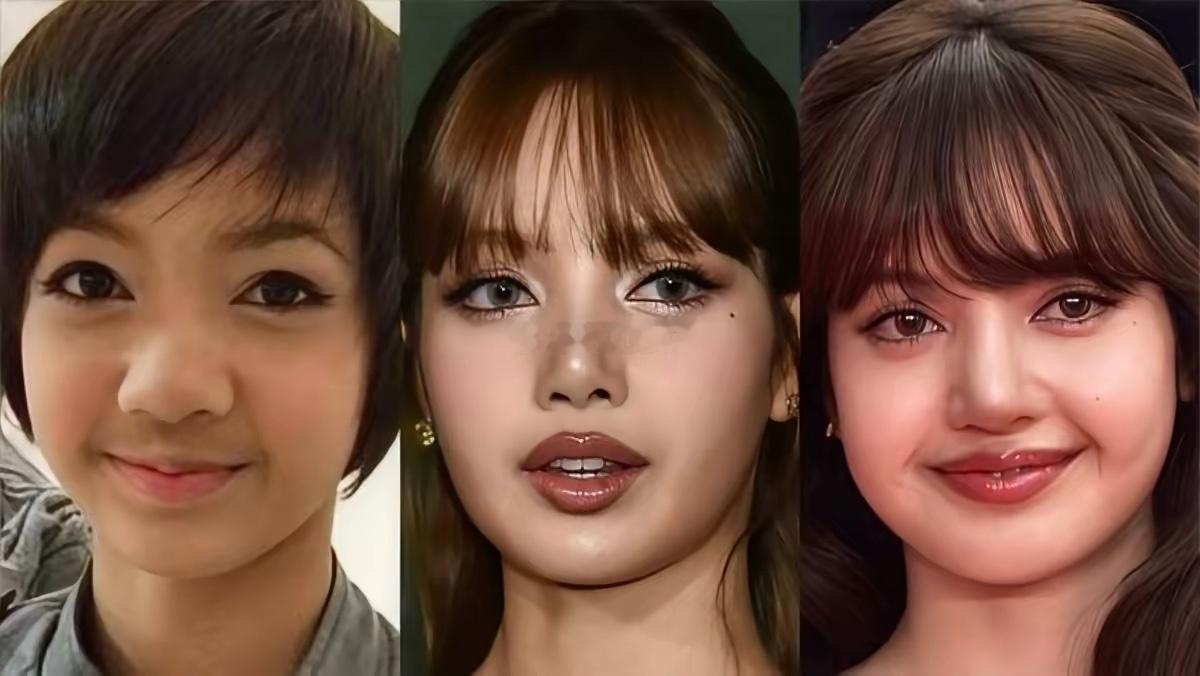 Lisa 的三次整容 