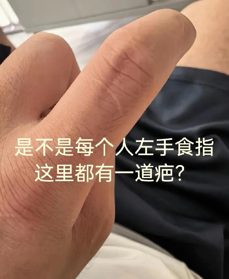 这个？