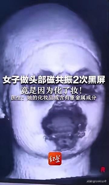 做核磁两次黑屏！居然是因为脸上的妆！​​​杭州一女子做头部磁共振，机器刚启动就黑