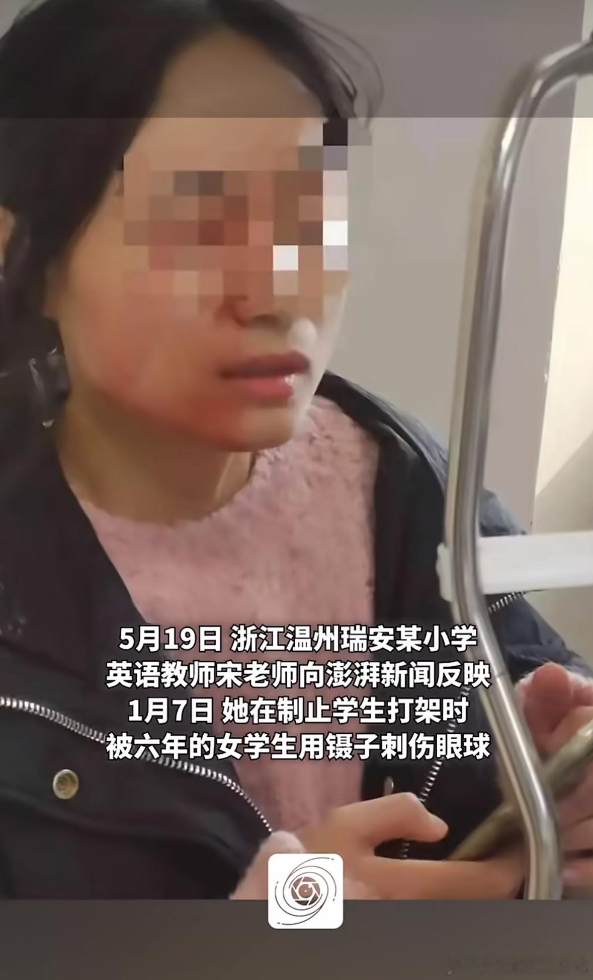 教育局称被戳伤老师调岗需统筹安排我们的制度和社会能否及时为基础教育的老师们“撑腰