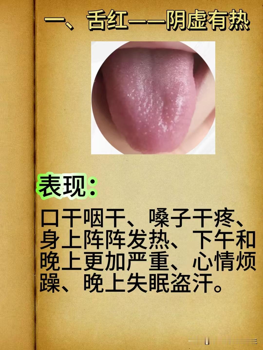 别划走！身体有虚有瘀，从舌头就能看出来！

一、舌红----阴虚有热

二、舌胖