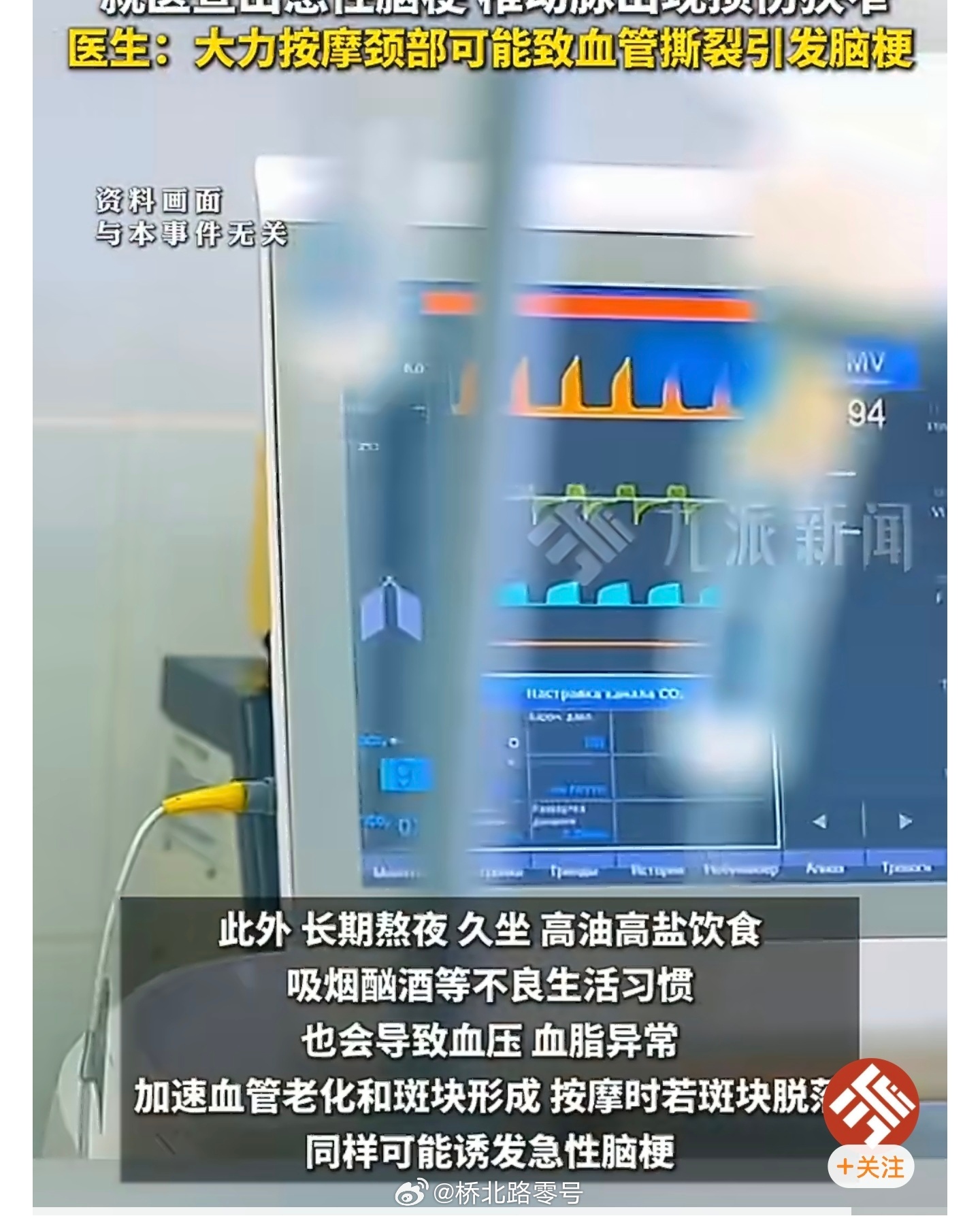 医生谈半月接诊3名按摩脑梗年轻人浙江一医院近半个月接连接诊三例，三位年轻人按摩后