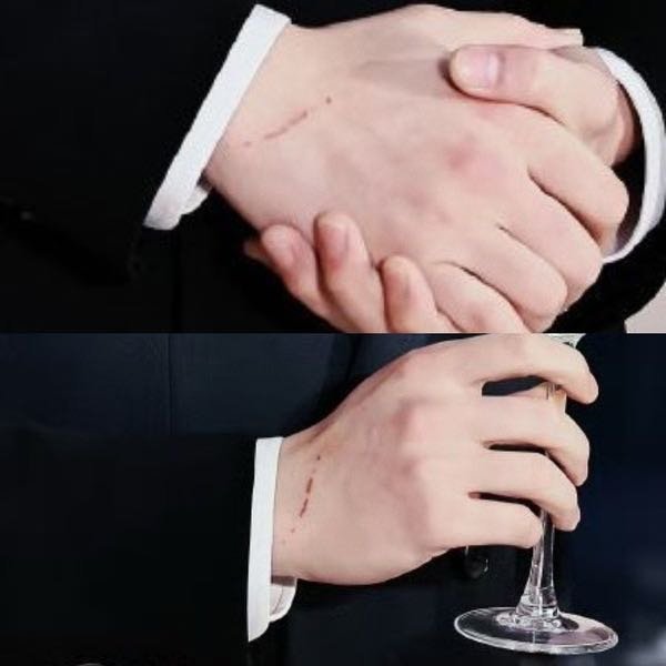 看起来好疼 ​​​