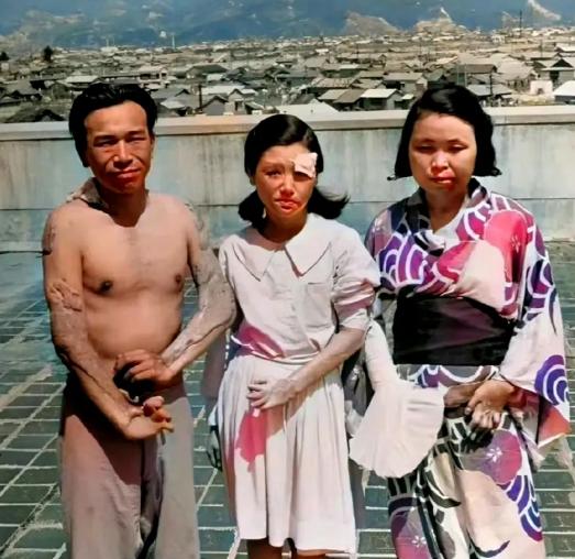1945年，广岛原子弹爆炸后，三个幸存者，留下了这一张照片，镜头中的他们眼神非常