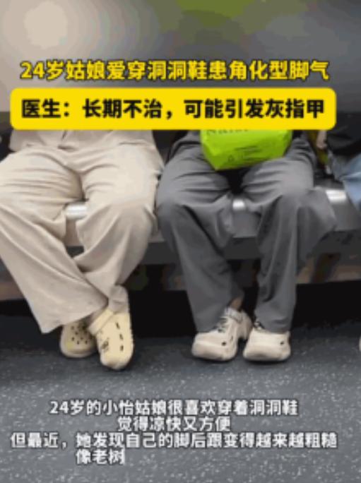 爱穿洞洞鞋的人天塌了！6月24日，一位年仅24岁的姑娘夏天双脚产生的汗液，本来想