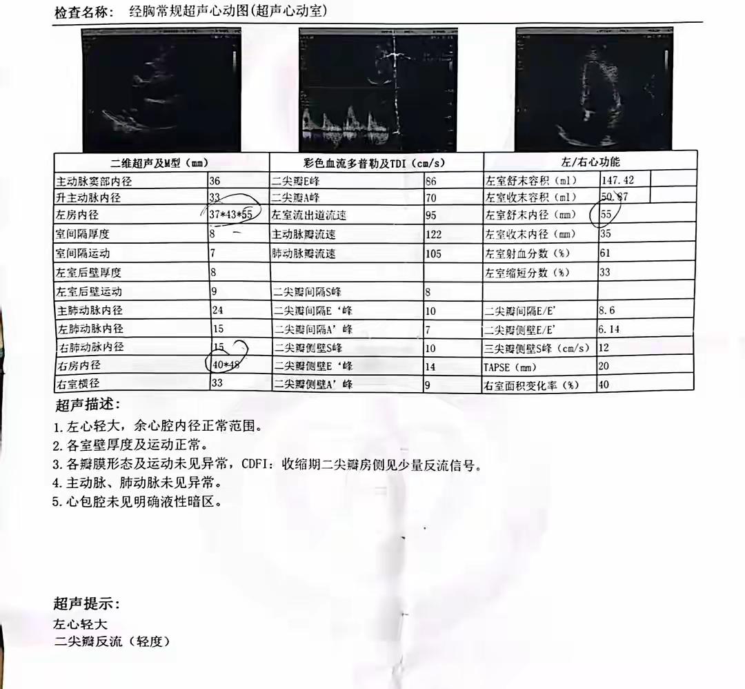 房颤4个半月左心房从“轻大”变正常，我只做了一件事
 
前几天发了篇文章，讲我房