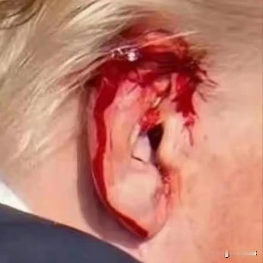 美国乱不乱，特朗普说了算！
   特朗普在宾夕法尼亚集会演讲上被枪击，右耳穿洞流