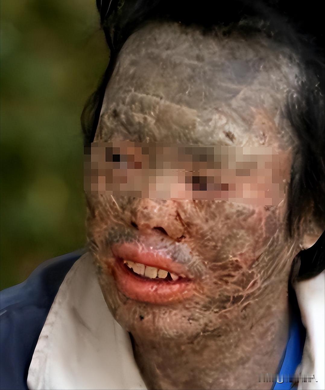 辽宁男子韩永波，沉迷于食用蛇肉，每天都要大快朵颐，尽管村里的人多次劝阻，可他偏追