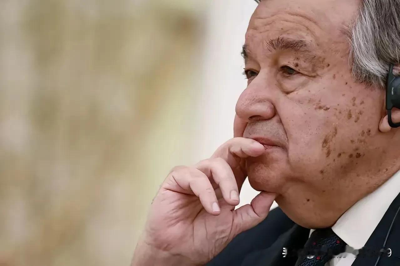 泽连斯基这是自辱，他学内塔尼亚胡也将联合国秘书长拒之门外，真是犹太人的风格。
 