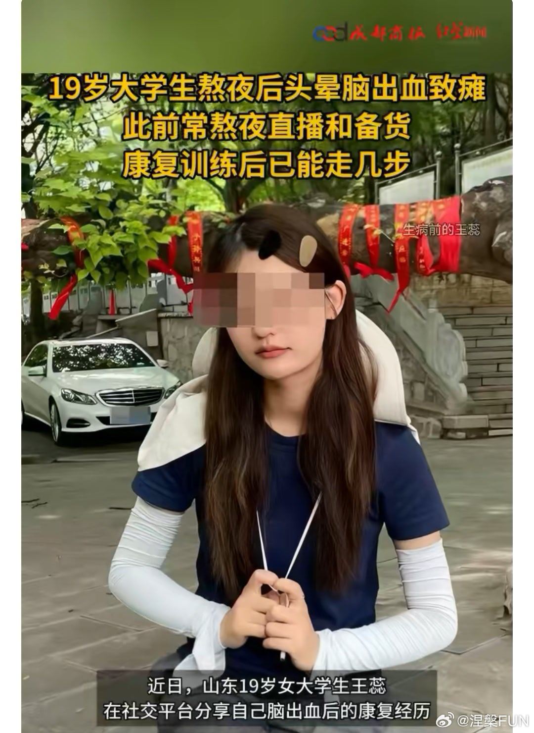 19岁大学生熬夜后脑出血致瘫前有张雪峰劳累工作强制锻炼，后有 19岁女大学生熬夜