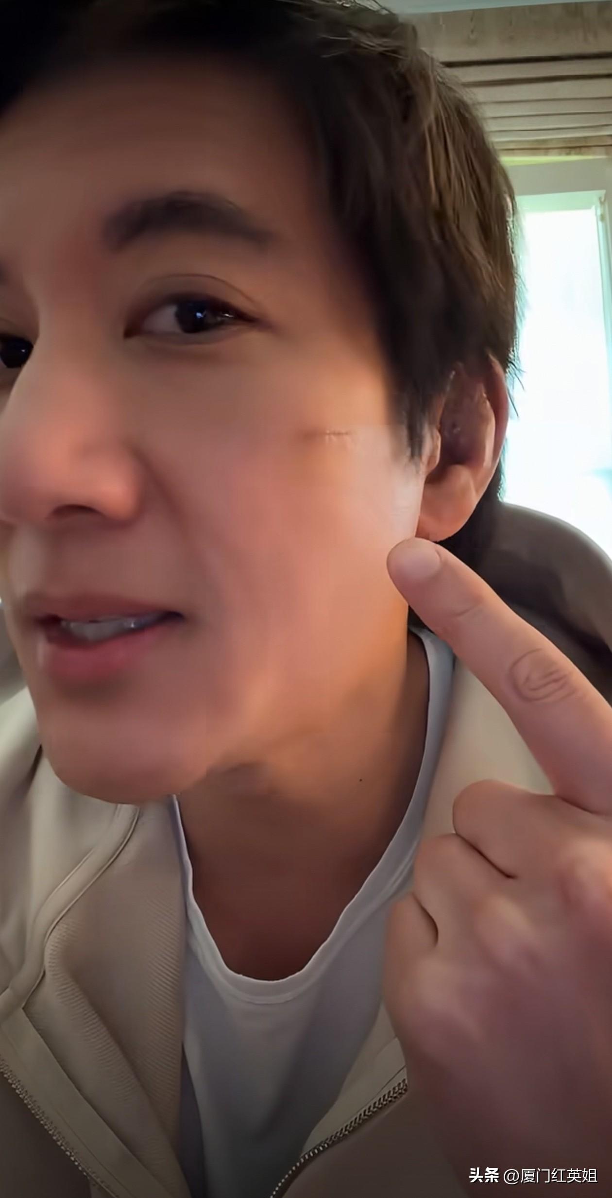 刚刚王力宏发布视频，在成都演唱会摔倒缝针的7天后，伤口已经基本恢复，同时宣布从长