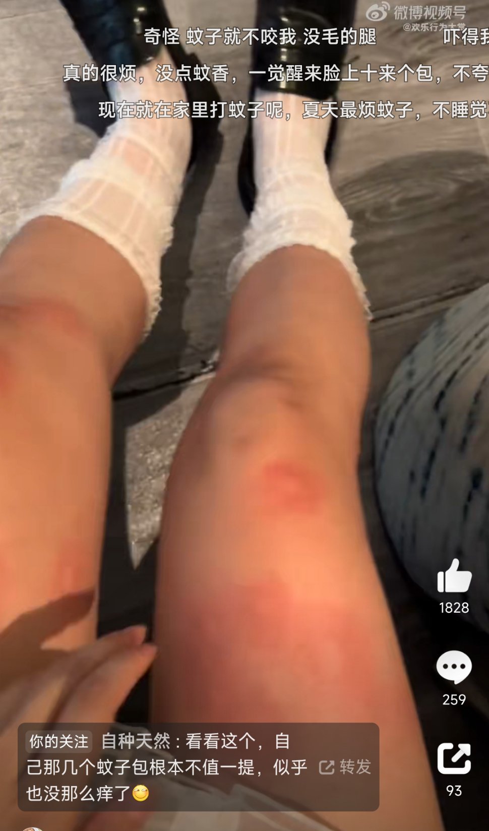 #一双腿养活了蚊子祖宗十八代#点开好震撼！蚊子的的确确有叮人偏好。在前臂戴尼龙长