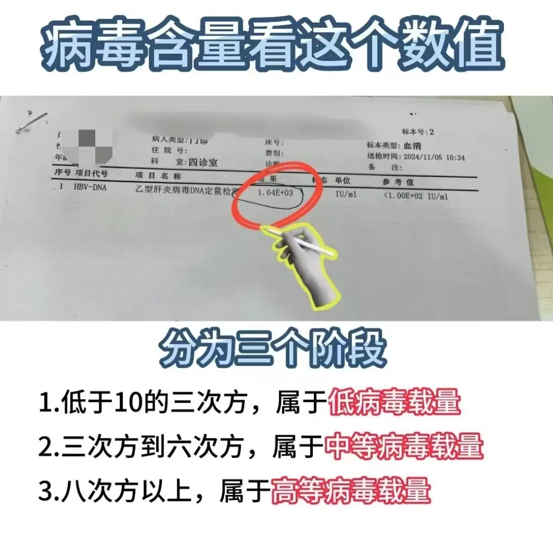 山东 乙肝 医学科普 保肝护肝