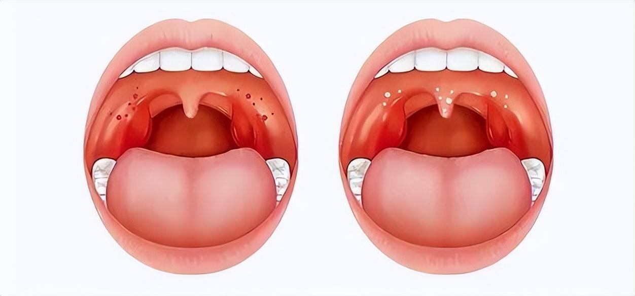 人体最没用的4个器官，割掉反而更好？有的人早就没有了

身体里有几个部位叫做"退