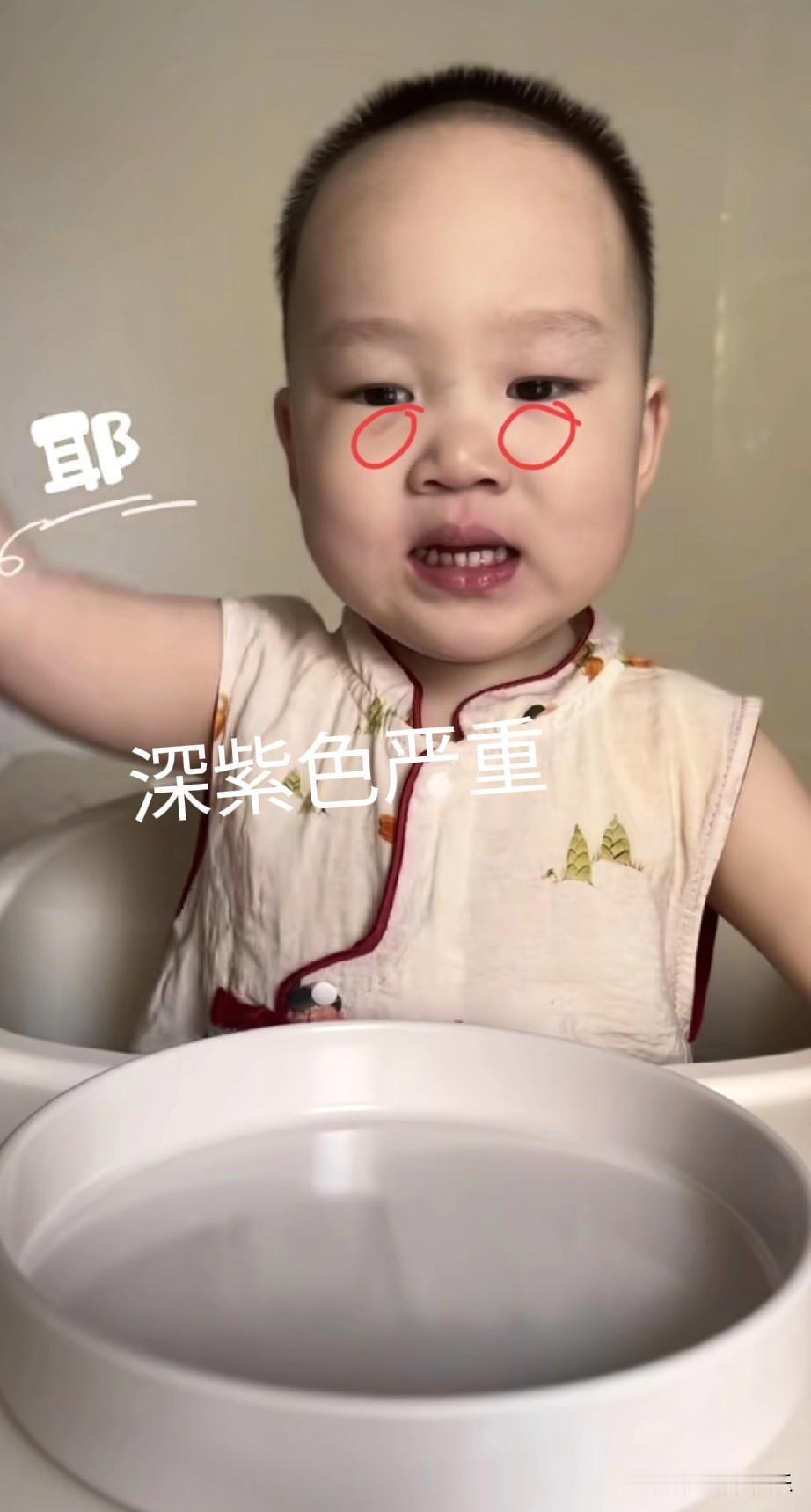 我外甥女已经查出了问题，
在此好心提醒一下米乐父母，
赶紧带孩子也去检查一下，别