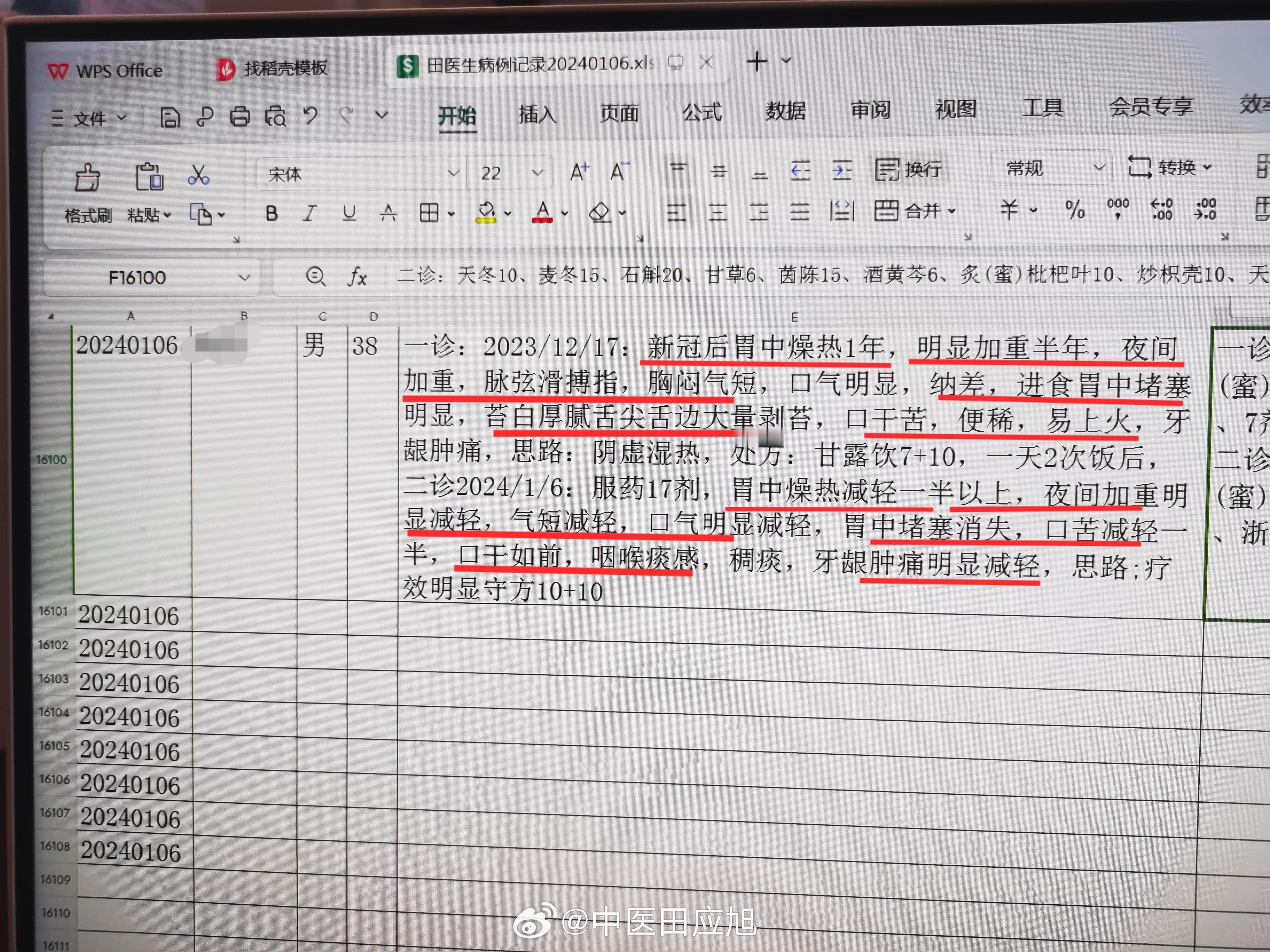 #中医##新冠后遗症# 比较冷门的新冠后遗症，男，38岁，新冠后胃中燥热1年，加