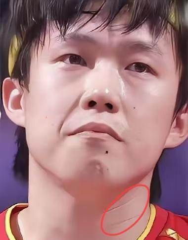 左手冠军，先挨骂再封神。
王楚钦12岁被省队嫌“反手软”，直接加练到凌晨；202