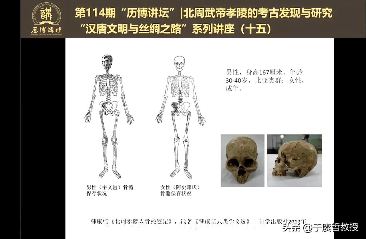 北周武帝身高167，他及他的突厥皇后的骨骼情况。图片来自“残兵弗雷德里希”。 ​