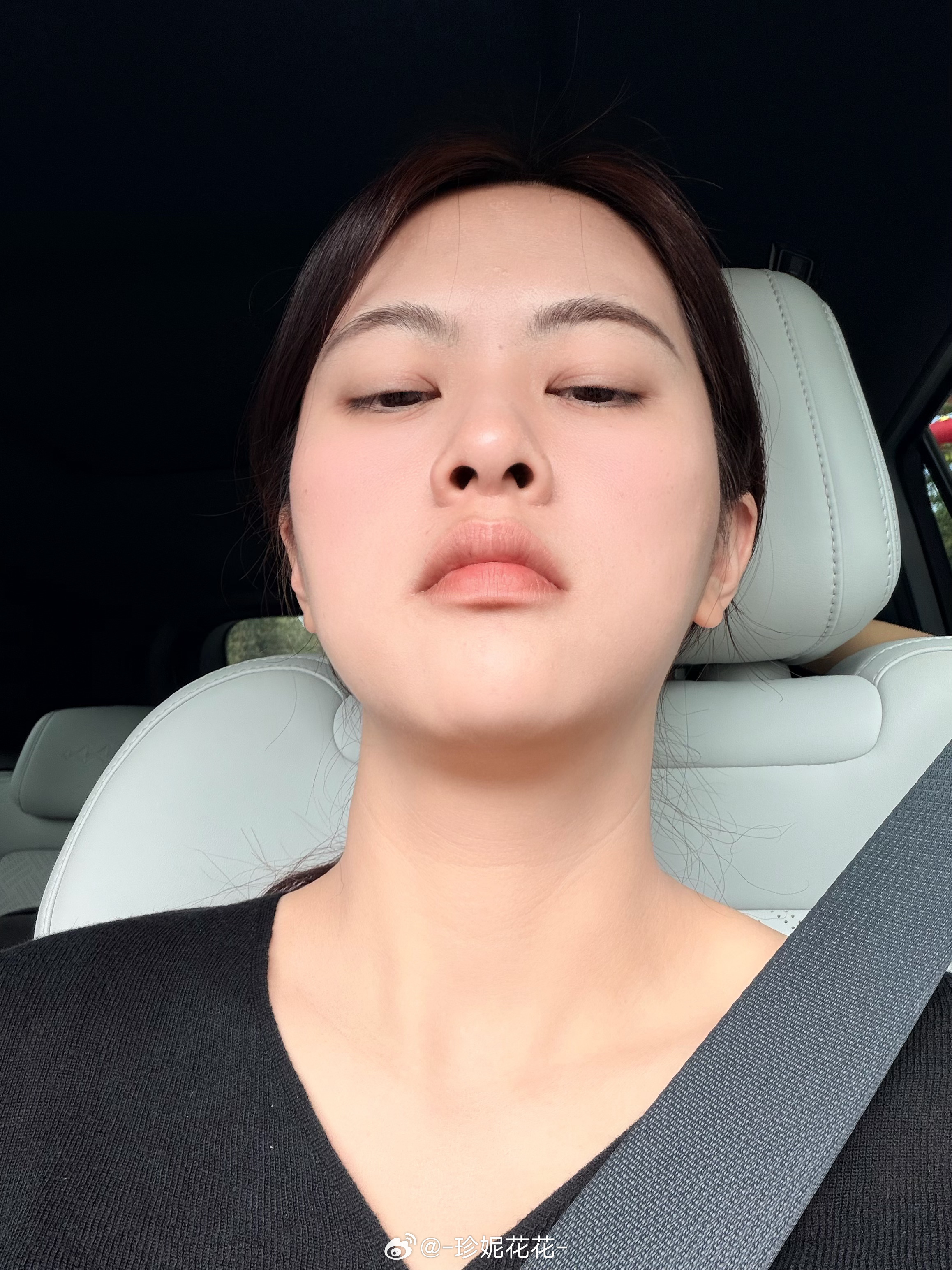 我现在脑袋嗡嗡响，倒时差太难受了 