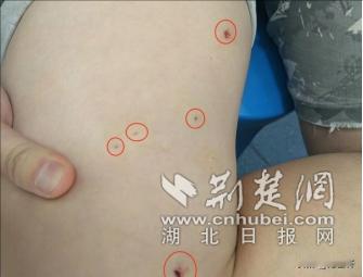 --“太狗血了！”湖北武汉，一男子在工作期间，轴承意外炸裂，导致铁屑喷射进刺入大