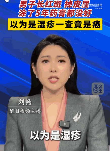 宁吃百日药，不挨五年痒！宁波，一40多岁男子这五年活得生不如死，浑身暗红斑片、奇