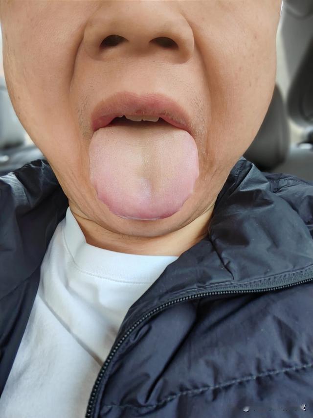 你一个大男人，血虚成这样，也是真的不多见[笑哭][笑哭][笑哭]
主诉：疲软，没
