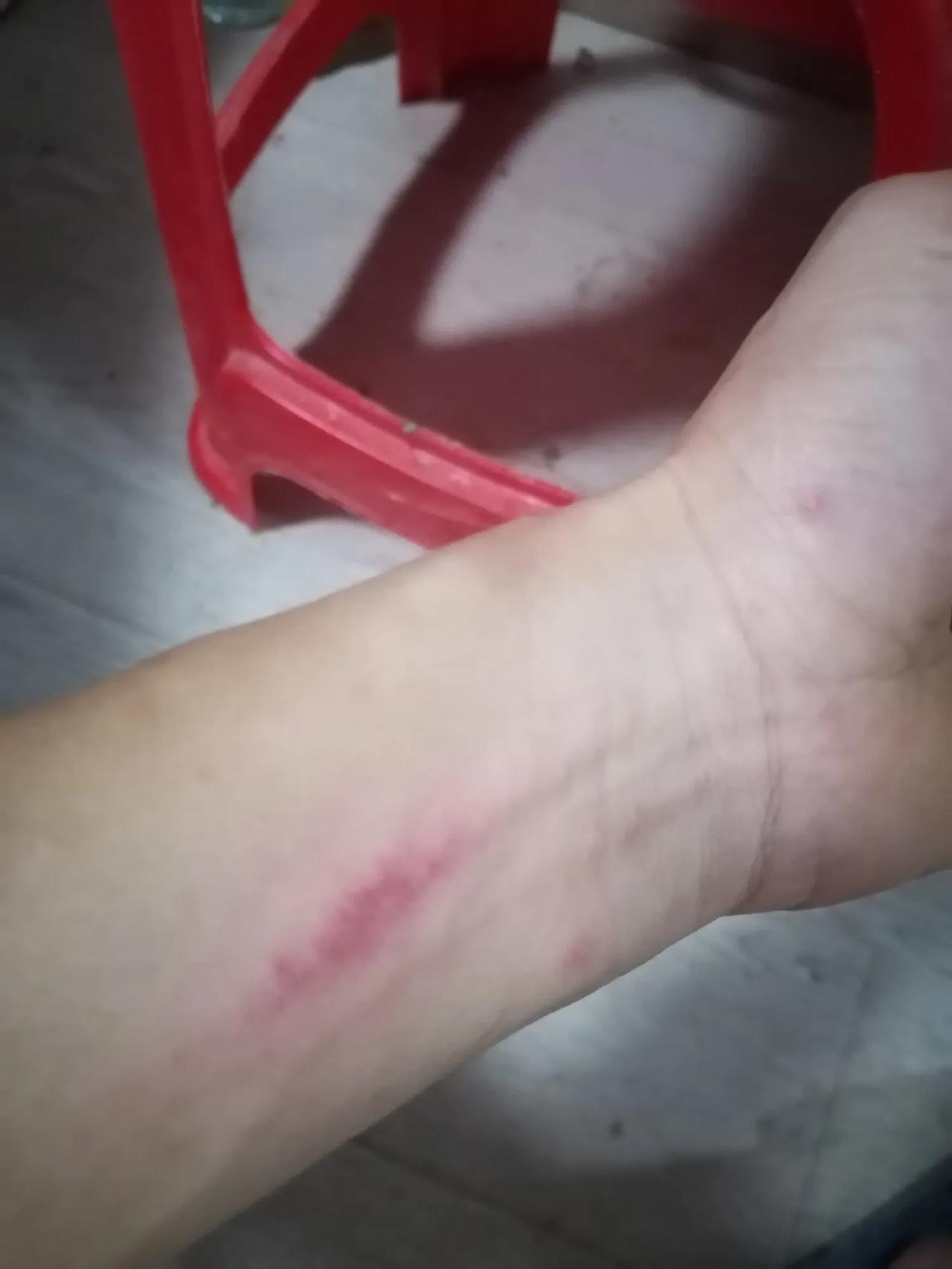 大家好，我是水电工星仔，昨天干吐了，幸好是下班的时候，才发的作，在回宿舍的路上吐