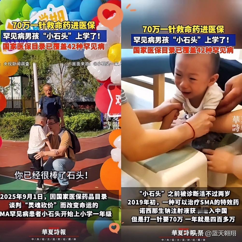 70万一针的救命药进医保，
小石头的人生大逆袭！
曾经，小石头这个脊髓性肌萎缩症