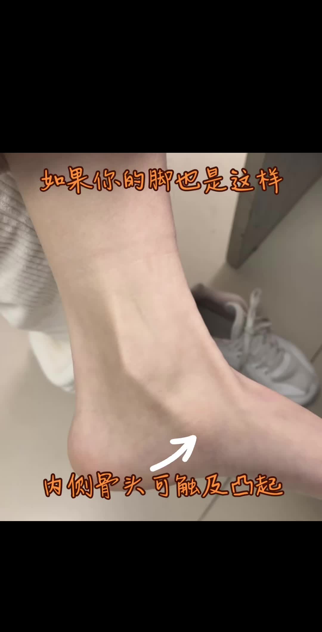 你是不是万里挑一的练武奇才呢 你的脚会不会也是这样