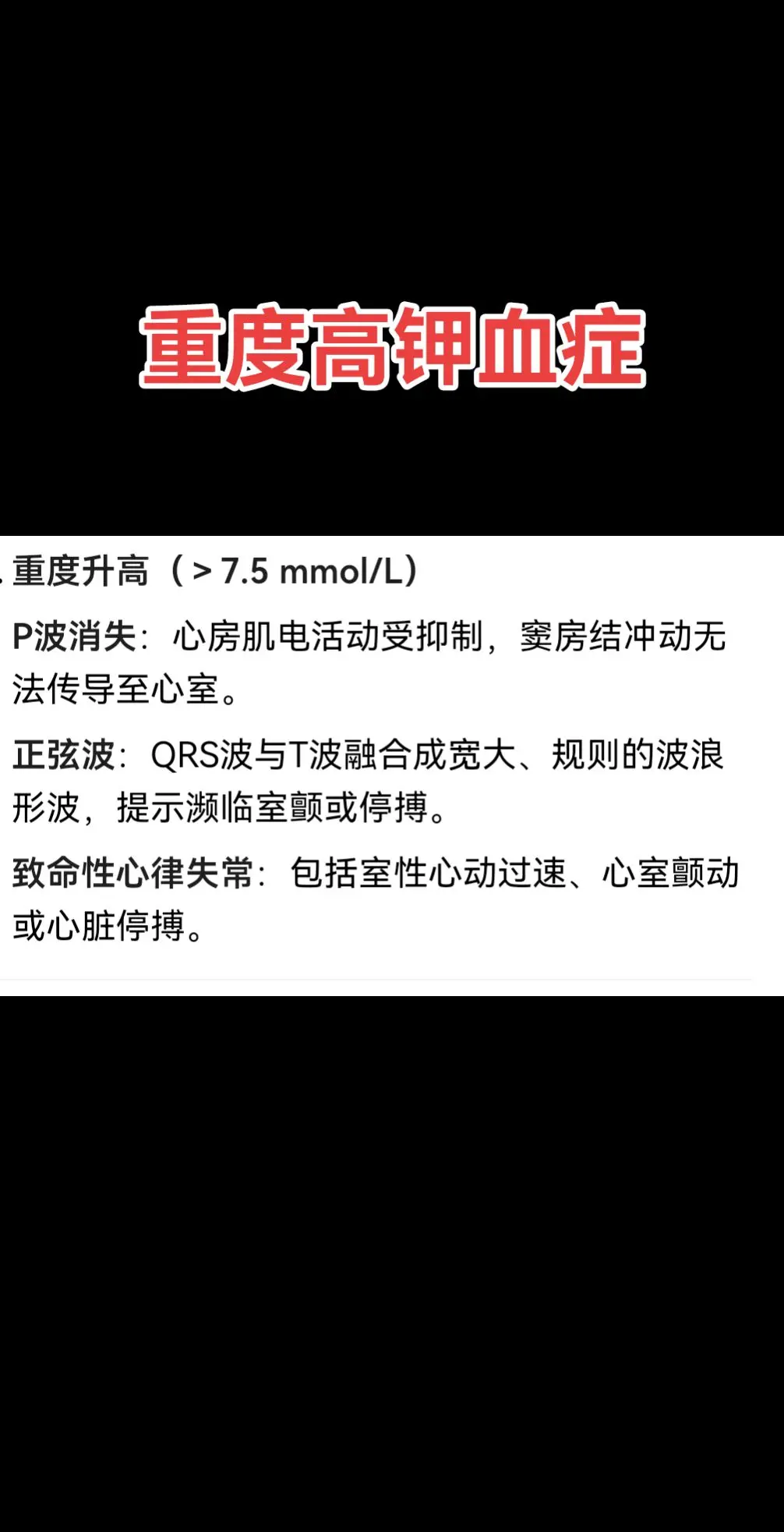 心电图