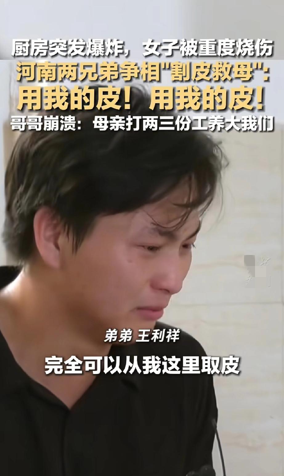 厨房爆炸母亲重度烧伤，河南两兄弟抢着“割皮救母”：“用我的皮！”
 
河南驻马店