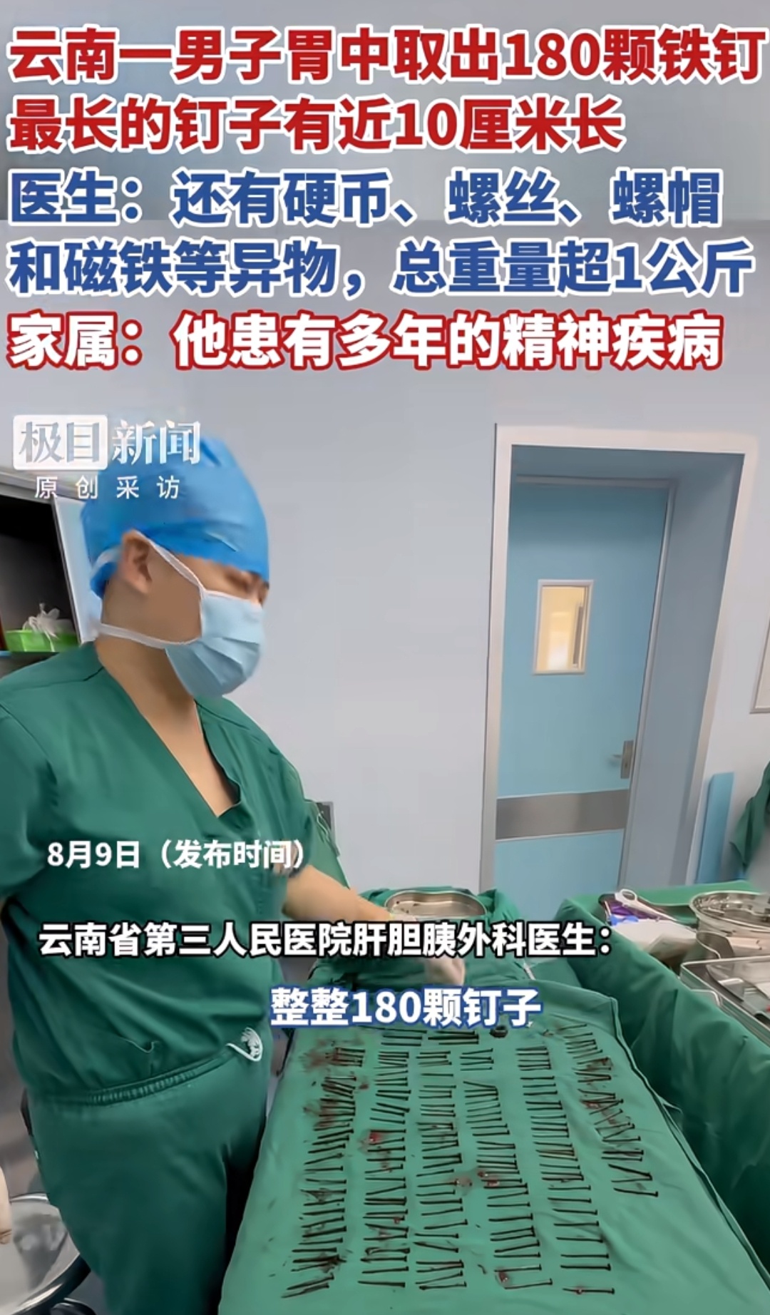 云南一男子胃中取出180颗铁钉 这个胃也是很厉害了 