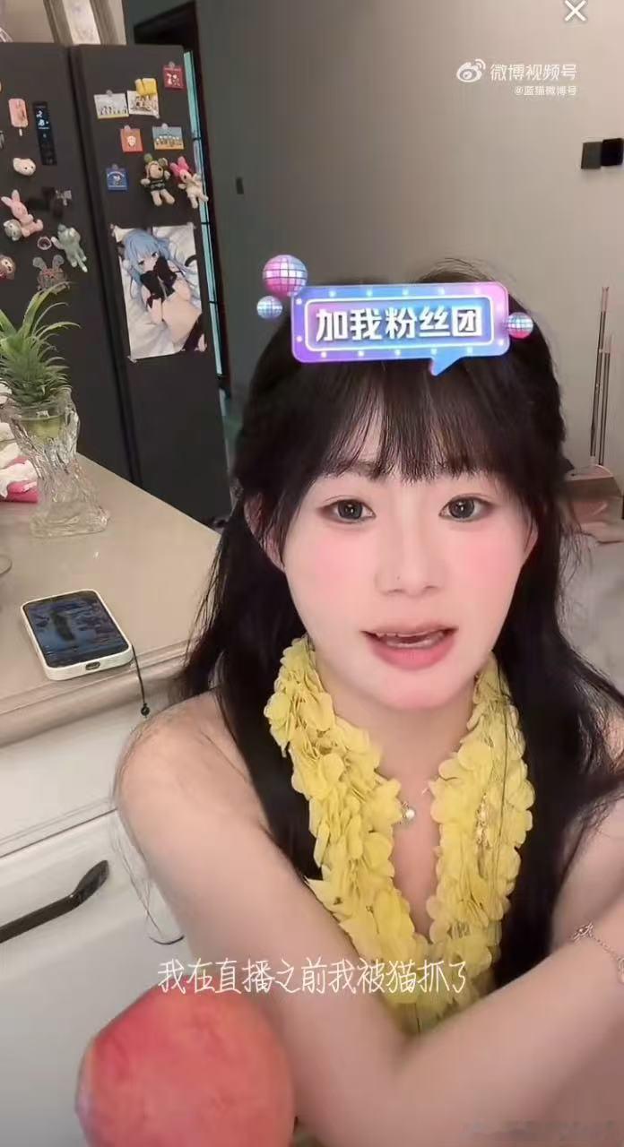 安静公主自曝被猫挠伤 撸猫需多加留意！安静公主晒出被猫咪抓伤的经历，说明宠物打闹
