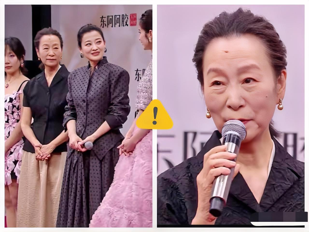 果然我不尴尬，
尴尬的就是别人！

奚美娟现身腾讯星光大赏的状态，直接把“人间清