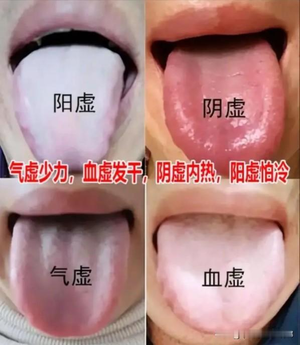 中医四大虚，气虚则懒、血虚则燥、阴虚则热、阳虚则冷，中医教你一招，阴阳平衡，气血