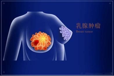 远离粉红杀手，守护乳腺健康——10.18 世界乳腺癌宣传日10月是乳腺癌防治月，