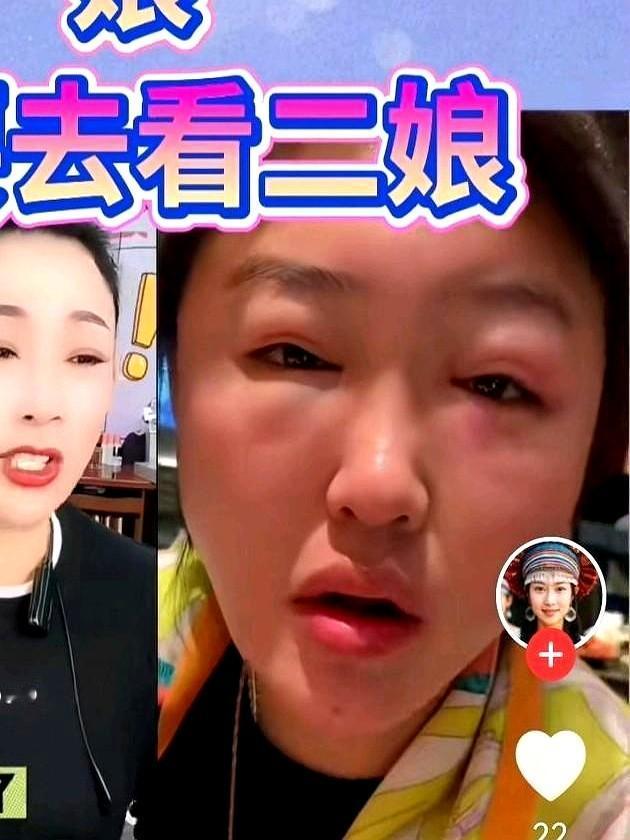 离开赵本山，曾被认为前途黯淡的娇娇，如今却活成了很多人意外的样子。

2022年