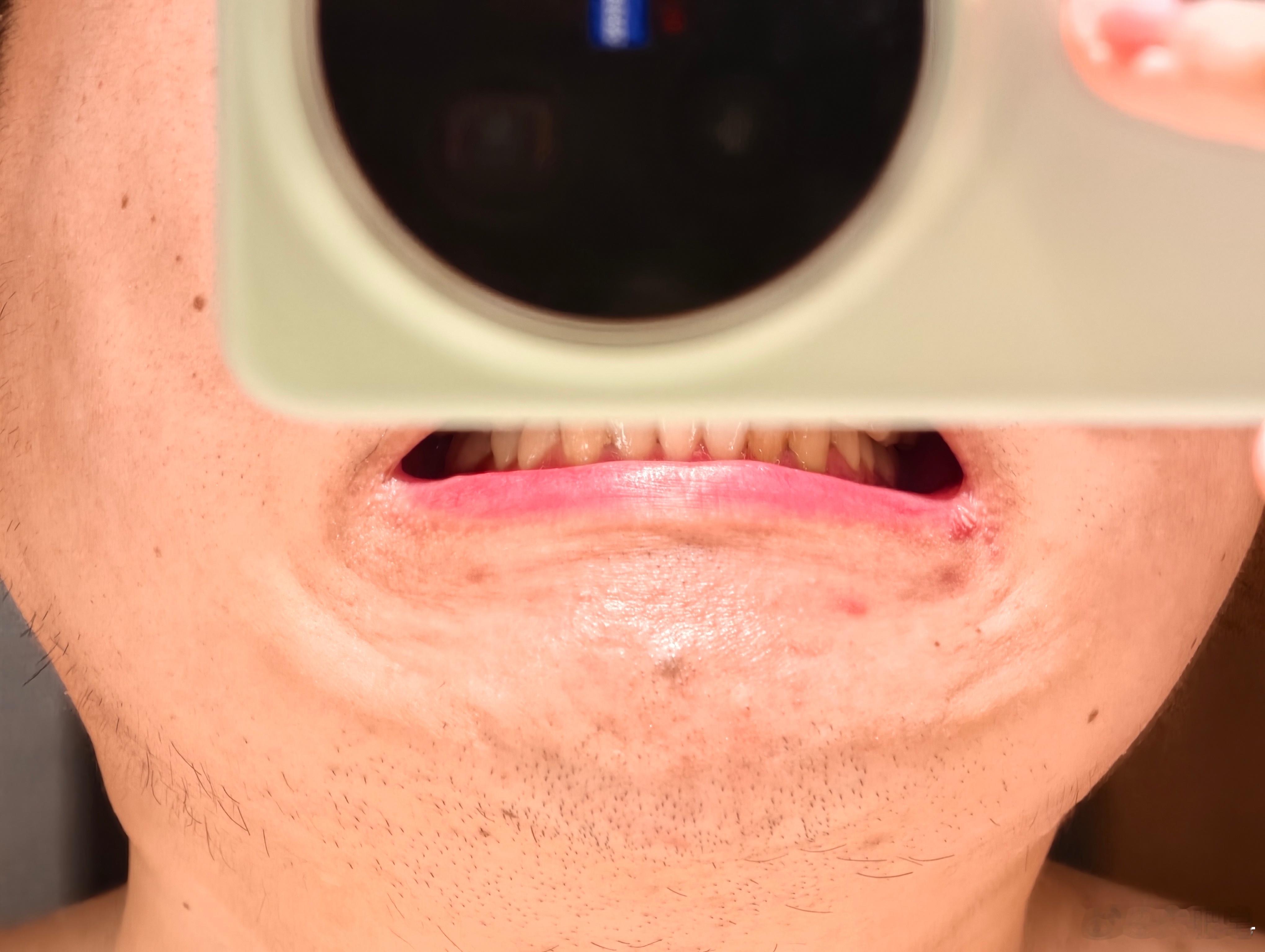 明天要去成都，星夜把胡子刮掉