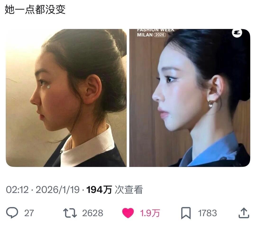 所以柳智敏到底整了哪里？ 