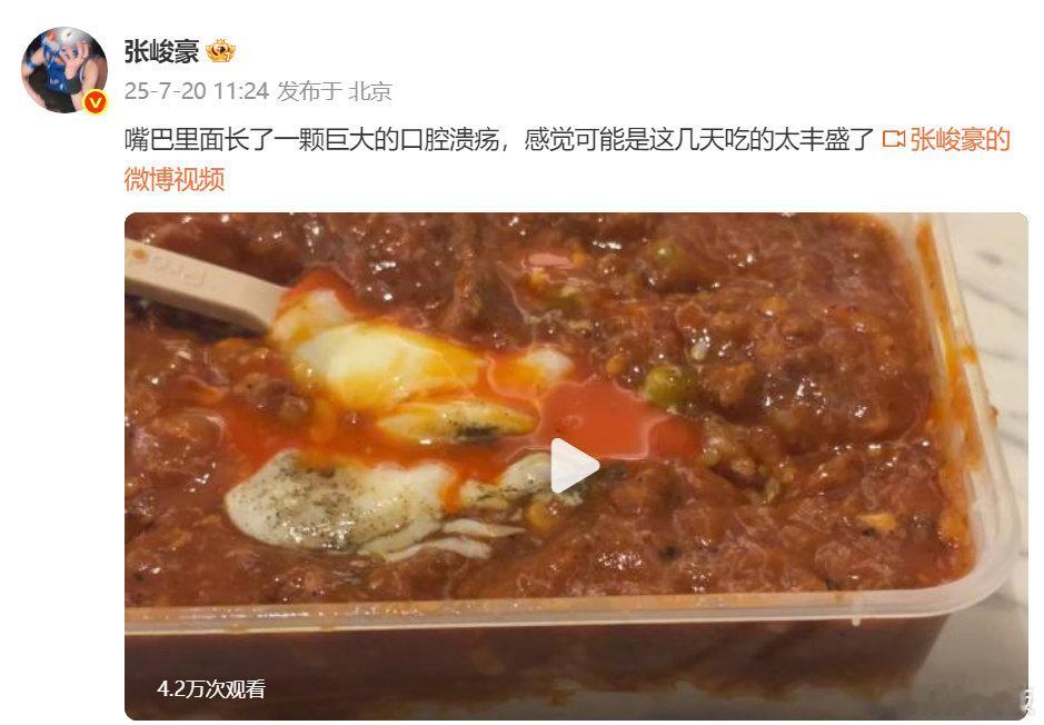 张峻豪口腔溃疡 张峻豪嘴里长了口腔溃疡，“感觉可能是这几天吃的太丰盛了”，下次录