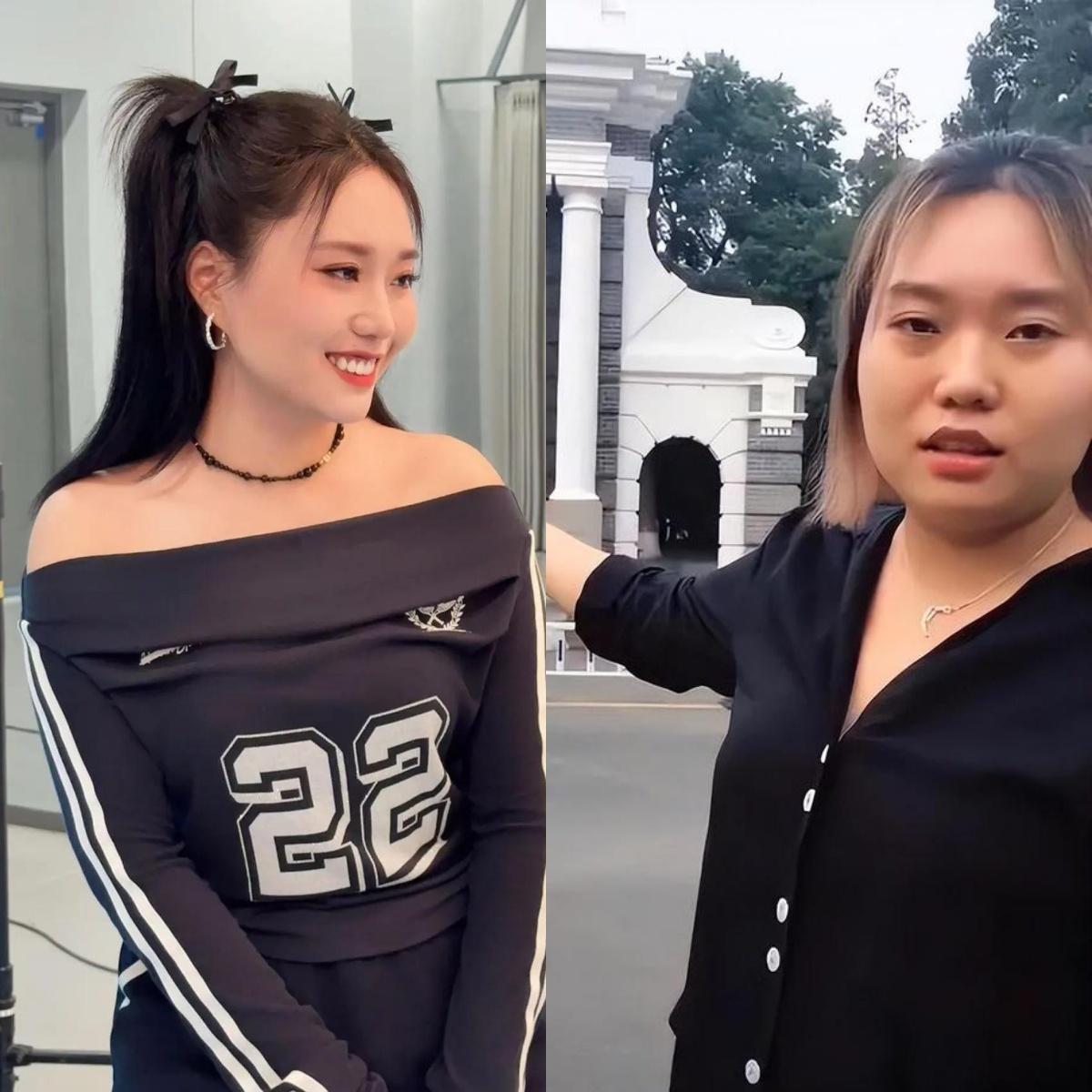 李雪琴一定是医美了！简直是换了个头！
我去，简直是太惊人了，李雪琴咋变成这样了？