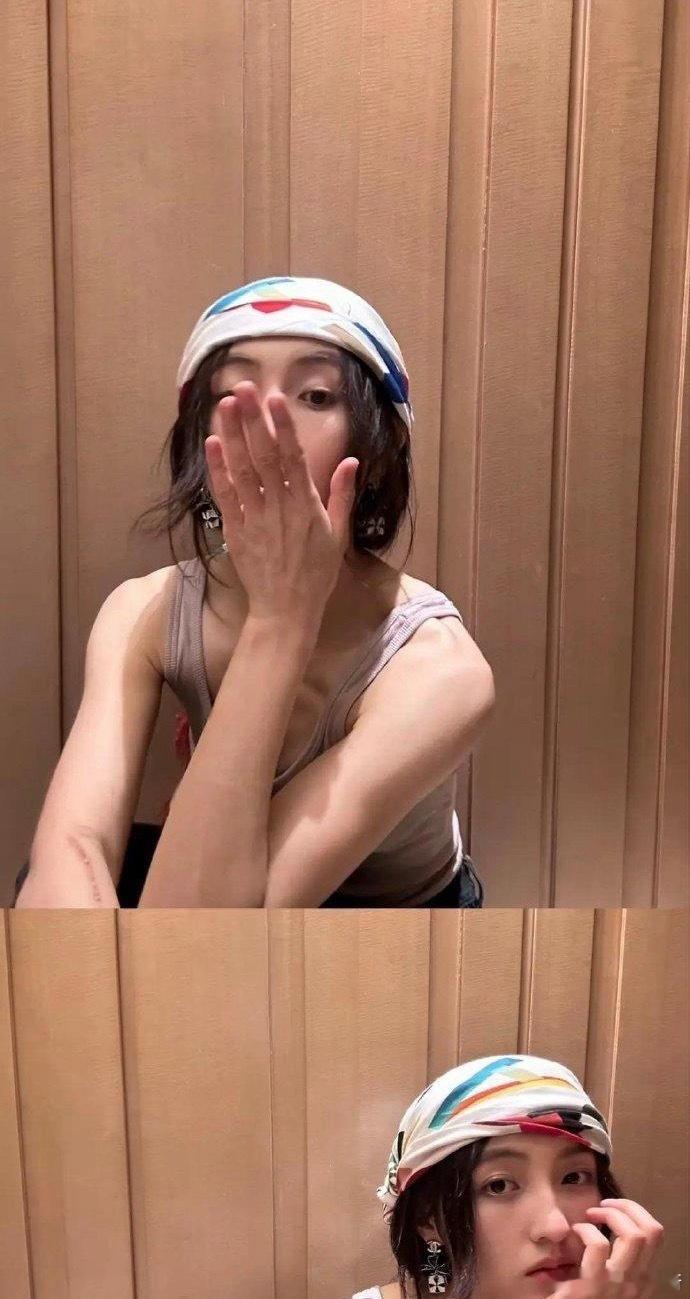 话说，张子枫这个疤怎么弄的啊好长好吓人。。 